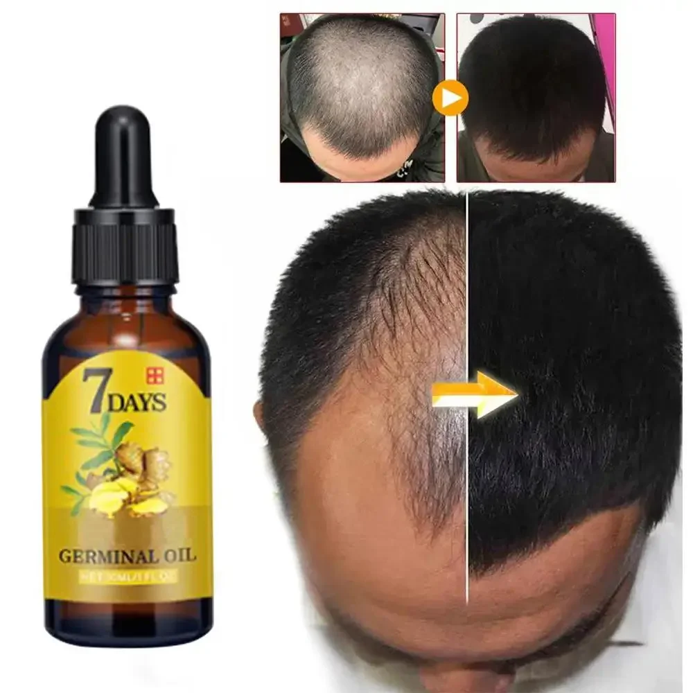 Caffeine Hair Serum - Aceite esencial de jengibre para el