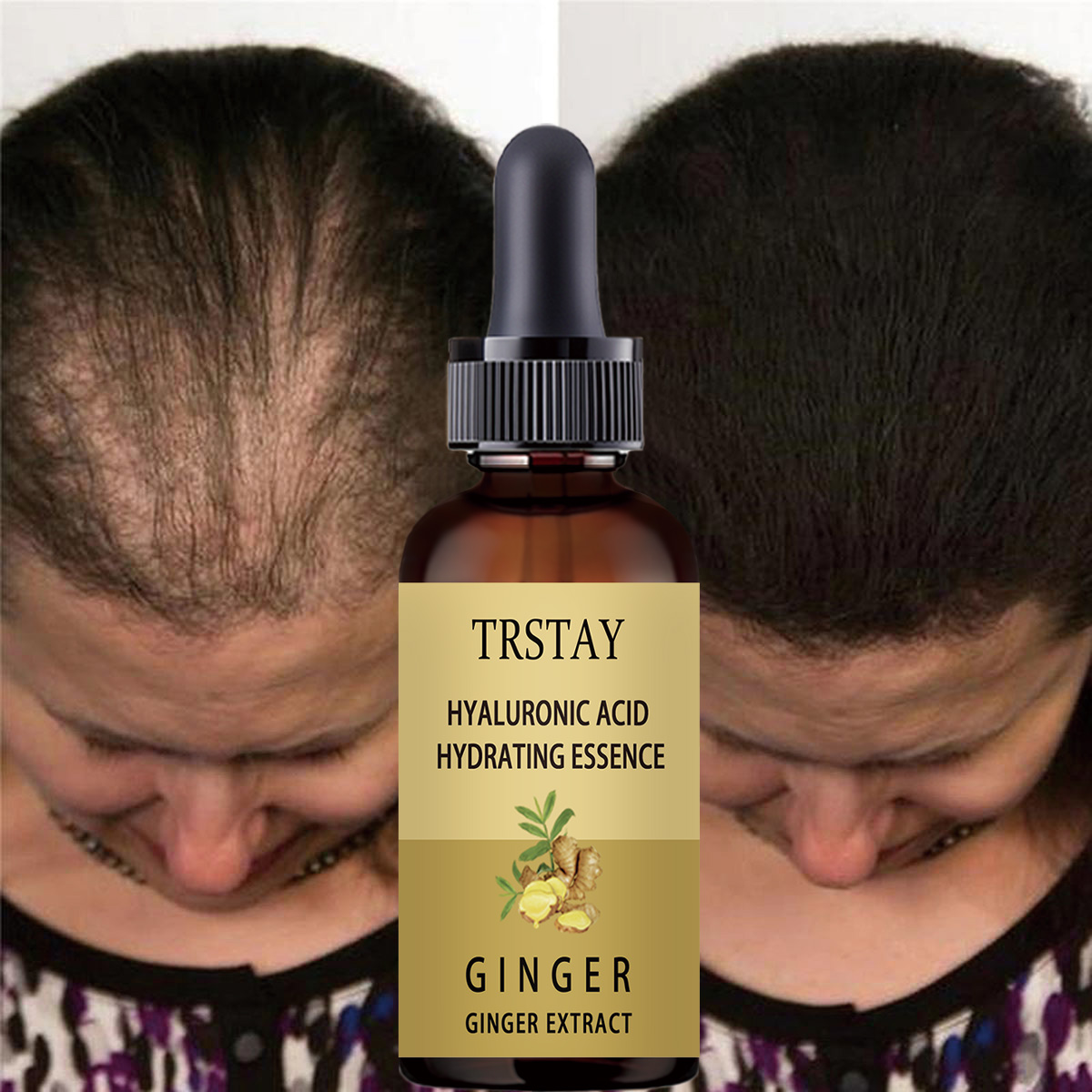 Suero para el crecimiento del  - Caffeine Hair Serum reseña y precio