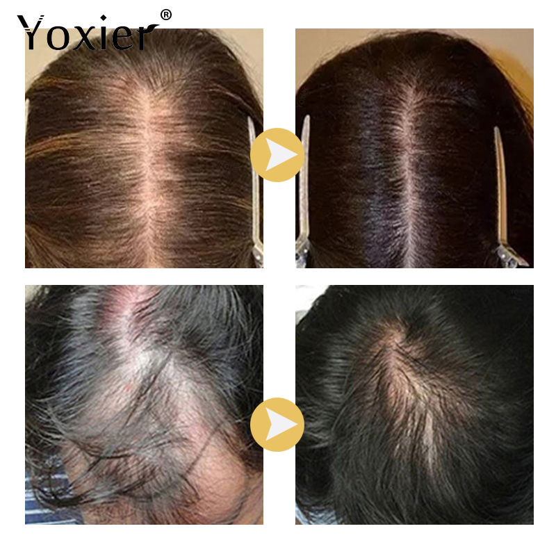 Suero de crecimiento intensivo - Hair Care For Hair Growth reseña y precio