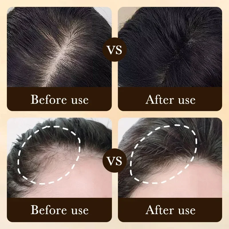Aceite de Biotina para el Crec - Caffeine Hair Serum reseña y precio