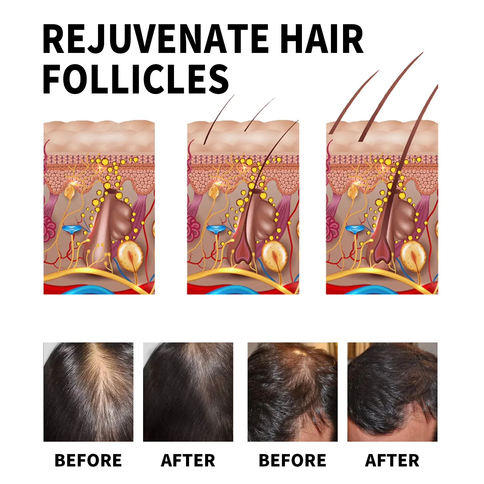 Productos para el crecimiento  - Hair Care For Dry And Frizzy Hair reseña y precio