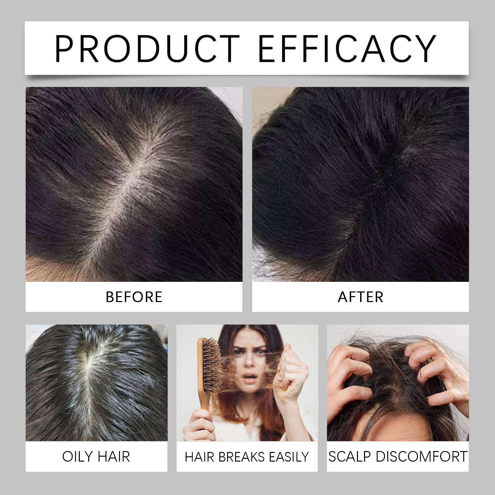 Polygonum Multiflorum Spray pa - Caffeine Hair Serum reseña y precio