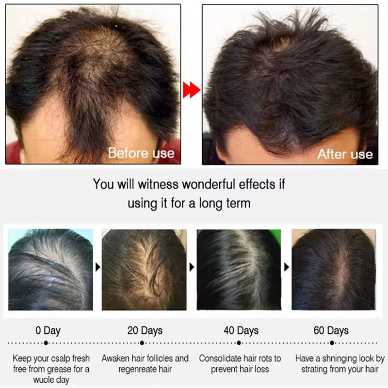 Spray de Crecimiento Rápido de - Hair Care For Hair Growth reseña y precio