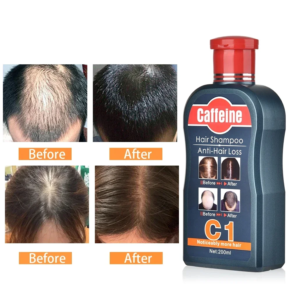 Champú para el crecimiento del - Hair Care Korean Products reseña y precio