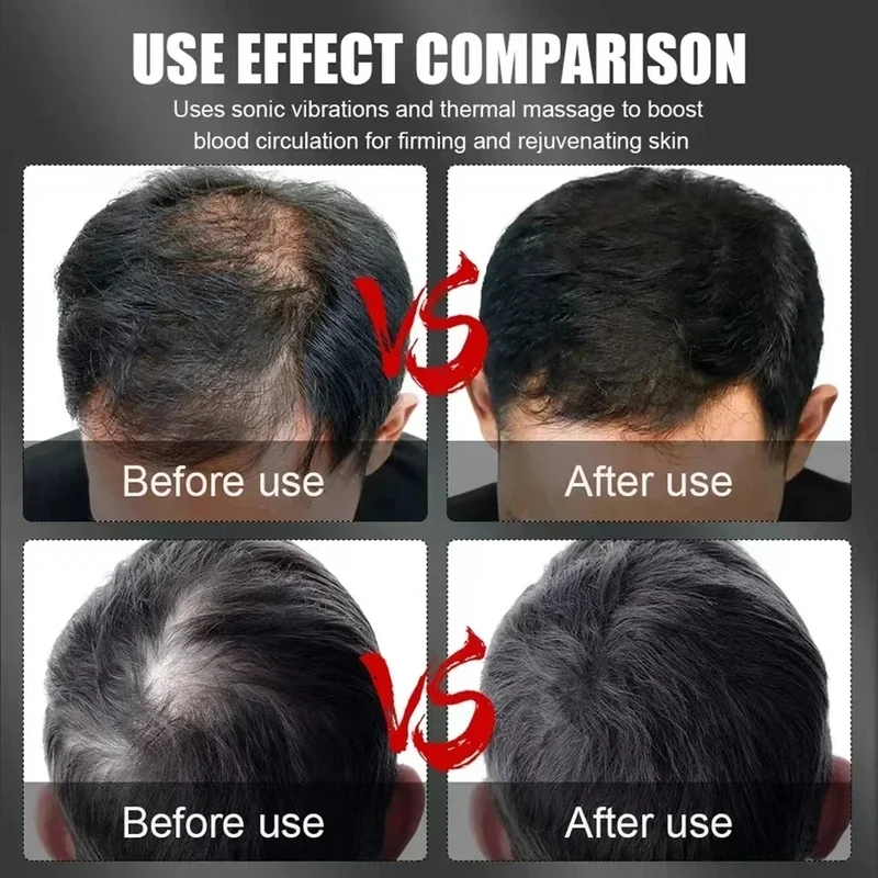 Gorro de Terapia Capilar con L - Hair Care For Hair Growth reseña y precio